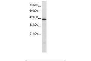 Image no. 1 for anti-HNF1 Homeobox B (HNF1B) (AA 43-92) antibody (ABIN202427) (HNF1B antibody  (AA 43-92))