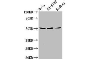Retinoic Acid Receptor gamma Antikörper  (AA 13-87)