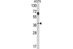 Western Blotting (WB) image for anti-Proteasome (Prosome, Macropain) 26S Subunit, Non-ATPase, 7 (PSMD7) antibody (ABIN3001710) (PSMD7 antibody)