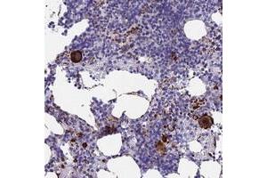 Immunohistochemical staining of human bone marrow with C15orf59 polyclonal antibody  shows strong cytoplasmic positivity in megakaryocytes at 1:500-1:1000 dilution. (C15ORF59 antibody)