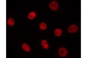ABIN6275620 staining Hela by IF/ICC. (T-Box 18 antibody  (Internal Region))