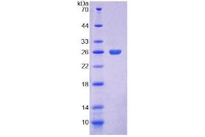 SDS-PAGE (SDS) image for CoA Synthase (COASY) (AA 316-501) protein (His tag) (ABIN6239497)