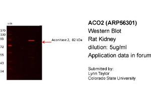 Western Blotting (WB) image for anti-Aconitase 2, Mitochondrial (ACO2) (N-Term) antibody (ABIN503915) (ACO2 antibody  (N-Term))