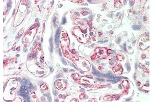 Rabbit Anti-SLC38A3 antibody  Formalin Fixed Paraffin Embedded Tissue: Human Placenta Primary antibody Concentration: 1:100 Secondary Antibody: Donkey anti-Rabbit-Cy3 Secondary Antibody Concentration: 1:200 Magnification: 20x Exposure Time: 0.