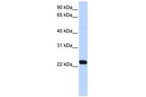 Image no. 1 for anti-Hepatitis B Virus X-Interacting Protein (HBXIP) (N-Term) antibody (ABIN6743628) (HBXIP antibody  (N-Term))