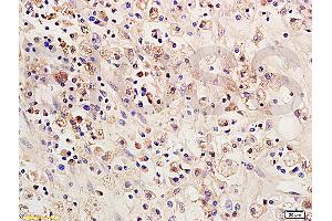 Formalin-fixed and paraffin embedded: rat brain tissue labeled with Anti-SOCS 1 Polyclonal Antibody (ABIN725135), Unconjugated 1:200 followed by conjugation to the secondary antibody and DAB staining (SOCS1 antibody  (AA 121-211))