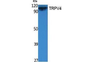 Western Blotting (WB) image for anti-Transient Receptor Potential Cation Channel, Subfamily V, Member 4 (TRPV4) (Internal Region) antibody (ABIN3187608) (TRPV4 antibody  (Internal Region))