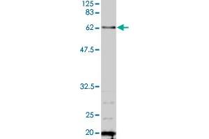 Detection of TAF6 by Western blotting using the TAF6 polyclonal antibody  . (TAF6 antibody  (AA 1-200))