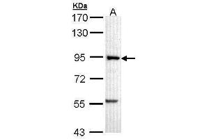 WB Image Sample (30 ug of whole cell lysate) A: A431 , 7. (PFKM antibody  (N-Term))