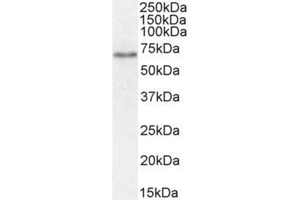 SLC5A1 antibody  (Internal Region)