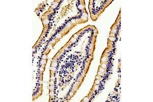 Immunohistochemical analysis of paraffin-embedded H. (Alkaline Phosphatase antibody  (AA 274-304))