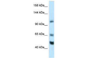 Western Blot showing Rest antibody used at a concentration of 1.