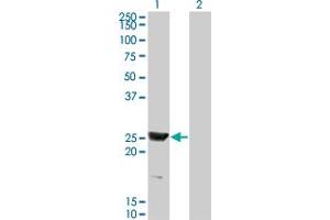 RAB15 antibody  (AA 99-208)