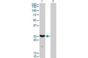 Western Blot analysis of RAB15 expression in transfected 293T cell line by RAB15 monoclonal antibody (M01), clone 1G12. (RAB15 antibody  (AA 99-208))