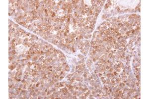 IHC-P Image GILT antibody detects IFI30 protein at cytosol on AGS xenograft by immunohistochemical analysis. (IFI30 antibody  (Center))