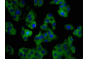 Immunofluorescence staining of HepG2 cells with ABIN7161089 at 1:100, counter-stained with DAPI. (SLC11A1 antibody  (AA 1-58))