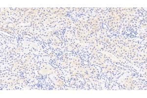 Detection of RGC32 in Human Kidney Tissue using Polyclonal Antibody to Response Gene To Complement 32 (RGC32) (RGC32 antibody  (AA 1-137))