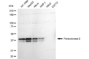 Western blotting analysis using Paraoxonase 2 antibody (ABIN7799735).