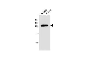 All lanes : Anti-Mouse Trem2 Antibody (N-term) at 1:500 dilution Lane 1: Mouse lung tissue lysate Lane 2: Mouse liver tissue lysate Lysates/proteins at 20 μg per lane. (TREM2 antibody  (N-Term))