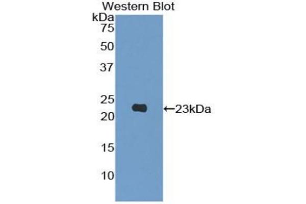 PIK3CB antibody  (AA 321-507)