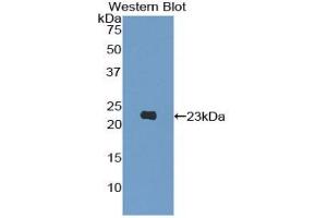 Detection of Recombinant PIK3Cb, Human using Polyclonal Antibody to Phosphoinositide-3-Kinase Catalytic Beta Polypeptide (PIK3Cb) (PIK3CB antibody  (AA 321-507))