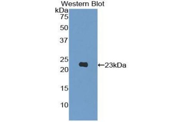 PIK3CB 抗体  (AA 321-507)
