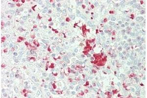 Human Spleen: Formalin-Fixed, Paraffin-Embedded (FFPE) (FBXL5 antibody  (AA 510-691))