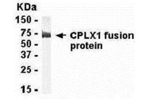 Western Blotting (WB) image for anti-Complexin 1 (CPLX1) (AA 1-134) antibody (ABIN2468059) (Complexin 1 antibody  (AA 1-134))