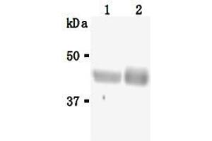 Western Blotting (WB) image for anti-Sialidase 3 (Membrane Sialidase) (Neu3) antibody (ABIN1449196) (Neu3 antibody)