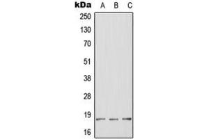 Western blot analysis of HES2 expression in HeLa (A), mouse brain (B), rat brain (C) whole cell lysates. (HES2 antibody  (Center))
