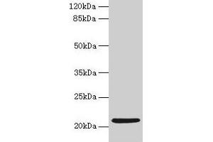 Western blot All lanes: COPZ1 antibody at 1 μg/mL + K562 whole cell lysate Secondary Goat polyclonal to rabbit IgG at 1/10000 dilution Predicted band size: 21, 15, 18, 22, 19 kDa Observed band size: 21 kDa