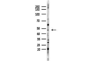 anti-Transforming Growth Factor, beta 2 (TGFB2) (C-Term) antibody