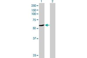 Western Blot analysis of CYP2A6 expression in transfected 293T cell line by CYP2A6 MaxPab polyclonal antibody. (CYP2A6 antibody  (AA 1-494))