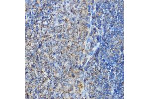 Immunohistochemistry of paraffin-embedded rat spleen using  Rabbit pAb (ABIN6127370, ABIN6137127, ABIN6137128 and ABIN6214982) at dilution of 1:100 (40x lens). (ARPC2 antibody  (AA 1-300))