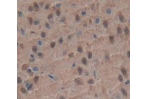 Figure. (IRAK2 antibody  (AA 209-458))