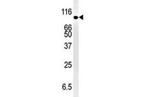 Image no. 1 for anti-SMAD Specific E3 Ubiquitin Protein Ligase 1 (SMURF1) (N-Term) antibody (ABIN357469) (SMURF1 antibody  (N-Term))