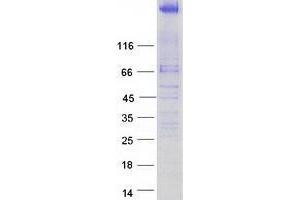 Tankyrase 1 Binding Protein 1, 182kDa (TNKS1BP1) protein (Myc-DYKDDDDK Tag)
