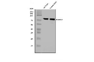 Western blot analysis of P2X7/P2RX7 using anti-P2X7/P2RX7 antibody (ABIN7601815).