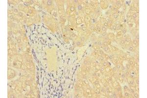 Immunohistochemistry of paraffin-embedded human liver tissue using ABIN7158927 at dilution of 1:100 (MR1 antibody  (AA 150-253))