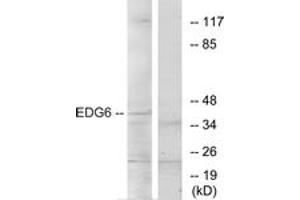Western blot analysis of extracts from K562 cells, using EDG6 Antibody.