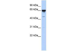 WB Suggested Anti-ZNF587 Antibody Titration:  0. (ZNF587 antibody  (Middle Region))