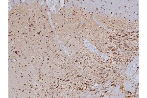 ABIN6267327 at 1/200 staining Rat brain tissue sections by IHC-P.
