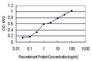 Detection limit for recombinant GST tagged RARB is approximately 0. (Retinoic Acid Receptor beta antibody  (AA 1-100))