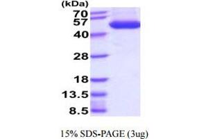 SDS-PAGE (SDS) image for Adenosylhomocysteinase (AHCY) (AA 1-432) protein (His tag) (ABIN6388020)