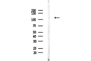 Western blot analysis of lysates from EC304 cells, using Phospho-HDAC4 (Ser632) Antibody at 1/1000 dilution.