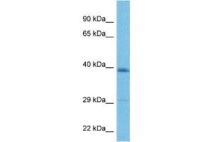 Host:  Rabbit  Target Name:  LAPTM4B  Sample Tissue:  Human MDA-MB-435s Whole Cell  Antibody Dilution:  1ug/ml (LAPTM4B antibody  (Middle Region))