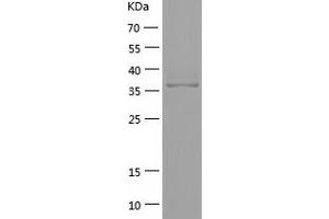 Western Blotting (WB) image for Eukaryotic Translation Initiation Factor 3, Subunit M (EIF3M) (AA 2-374) protein (His tag) (ABIN7287732) (Eukaryotic Translation Initiation Factor 3, Subunit M (EIF3M) (AA 2-374) protein (His tag))