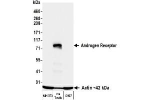 Western Blotting (WB) image for anti-Androgen Receptor (AR) (AA 1-50) antibody (ABIN7795785) (Recombinant Androgen Receptor antibody  (AA 1-50))