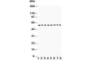 Western blot testing of Beclin 1 antibody and Lane 1:  COLO320;  2: HepG2;  3: PANC;  4: A431;  5: SMMC-7721;  6: Jurkat;  7: SW620;  8: U87 lysate. (Beclin 1 antibody  (AA 1-354))