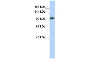 RNF31 antibody used at 1 ug/ml to detect target protein.